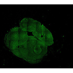 11PCW human midbrain